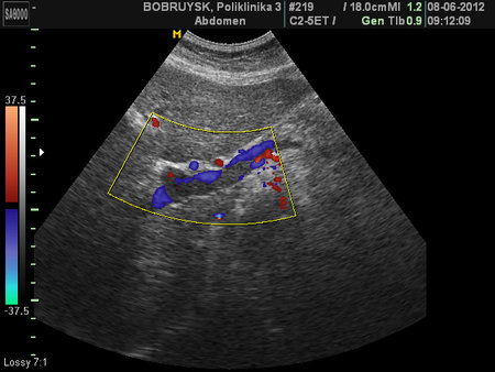 TROMB_25.JPG (127.5 КБ) 2391 просмотр ЦДК, промб в левой ветви ВВ.