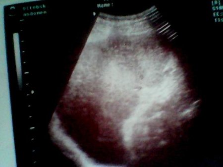 IMG_20150305_155313.jpg (20.46 КБ) 1595 просмотров Прошу прощения за качество.Это фото с бумажного носителя