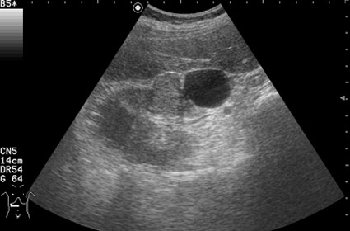 AABH.jpg (24.04 КБ) 3242 просмотра Поперечное серошкальное сканирование.